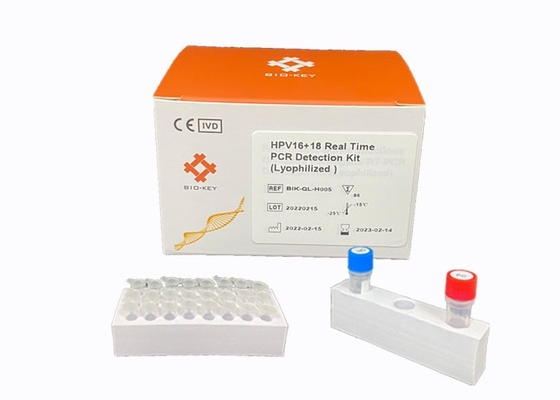 Zestaw Real Time HPV PCR Wykrywaj genotypowanie wysokiego ryzyka Test sondy Taqman dla wirusa HPV